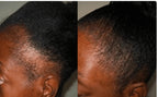 Bottle of Queen Tee's Herbal Teas and Tinctures 100% Honduras Batana Oil for skin and hair, shown alongside hair growth results.