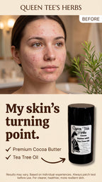 Queen Tee's Premium Cocoa Butter with Tea Tree Oil, 1 oz, self-care product for skin nourishment and soothing relief.